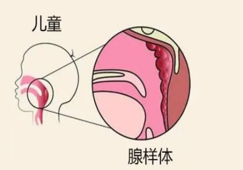 二胎時間間隔多久性別有差異，附生二胎注意事項