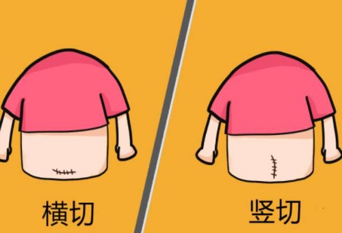 孕中期胎停的原因有哪些，胎停多半和這三點(diǎn)有關(guān)