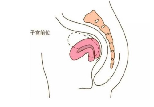11號(hào)染色體倒位對(duì)胎兒的影響很大，附11號(hào)染色體倒位的癥狀